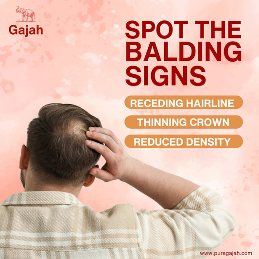 Male Pattern Baldness: Understanding the Signs and Taking Action