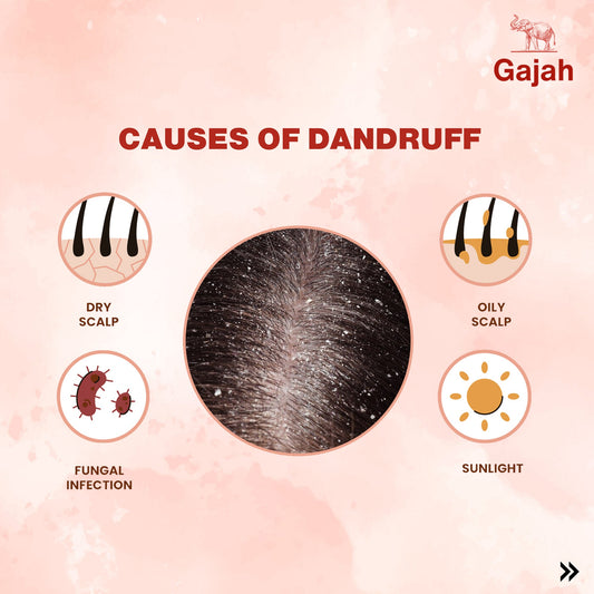 Struggling with Dandruff? Discover the Best Natural Solutions to Prevent Hair Loss, Control Dandruff, and Promote Regrowth with Gajah Hair Tonic! 🌟